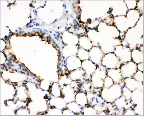 product-image-AAA11521_IHC3.jpg