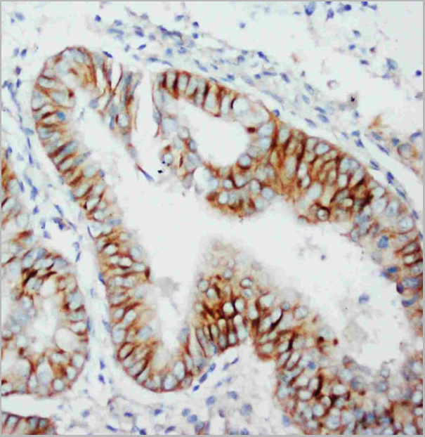 product-image-AAA11522_IHC2.jpg