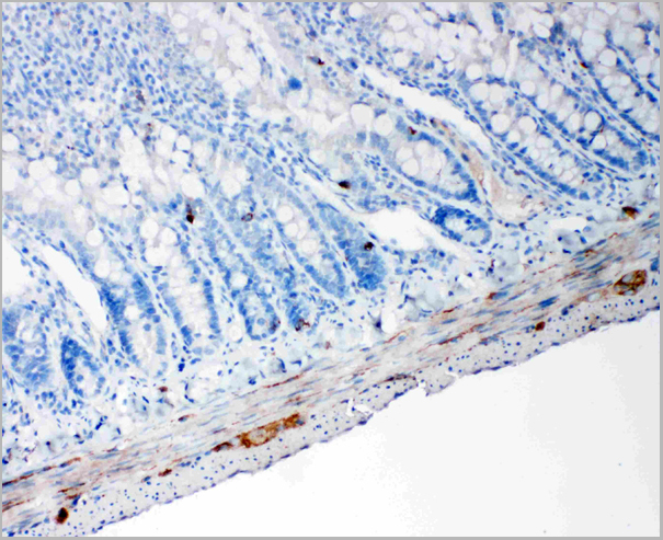 product-image-AAA11585_IHC2.jpg