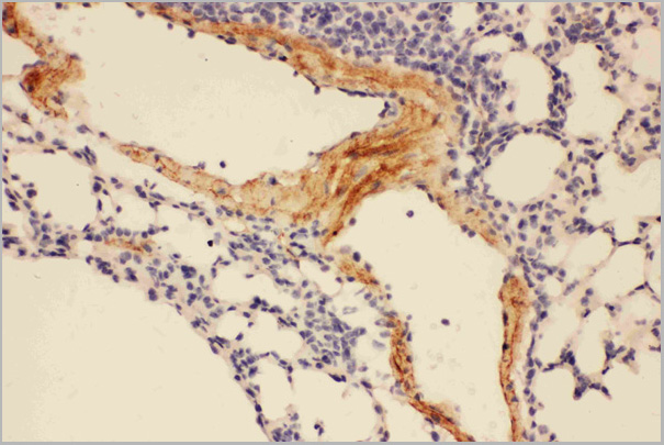 product-image-AAA11602_IHC.jpg