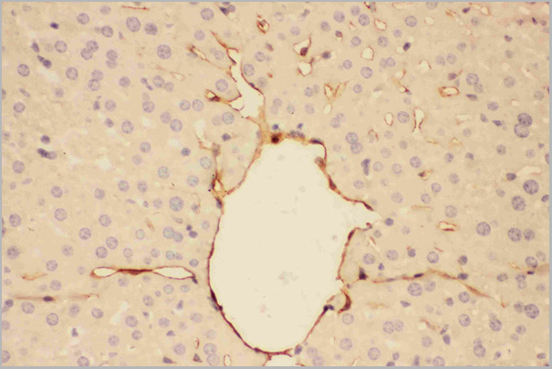 product-image-AAA11602_IHC2.jpg