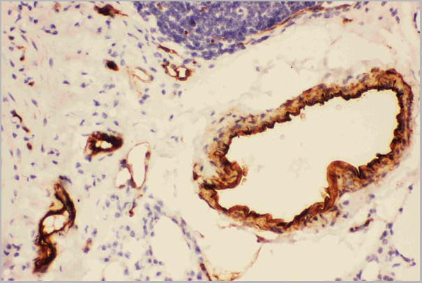product-image-AAA11602_IHC4.jpg