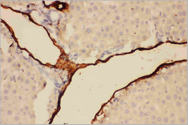 product-image-AAA11602_IHC5.jpg