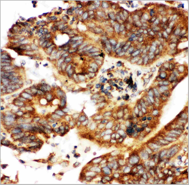 product-image-AAA11603_IHC.jpg