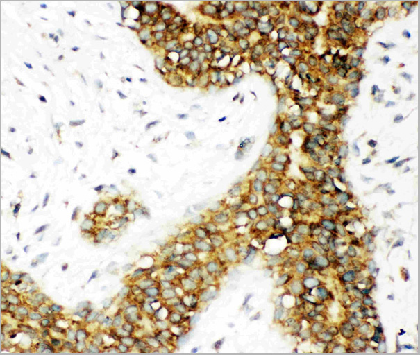product-image-AAA11603_IHC2.jpg