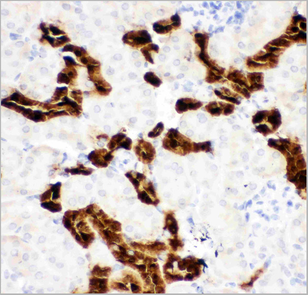 product-image-AAA11603_IHC3.jpg