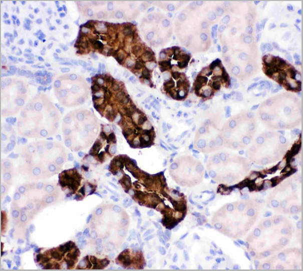 product-image-AAA11603_IHC4.jpg