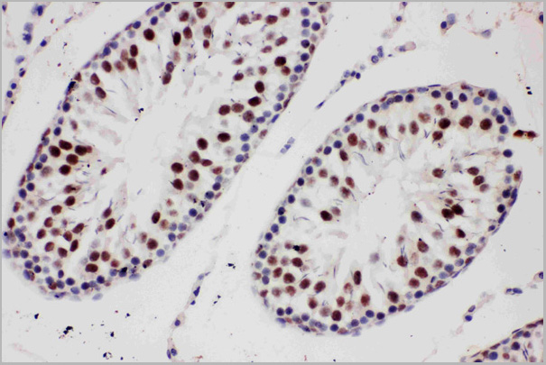product-image-AAA11605_IHC2.jpg