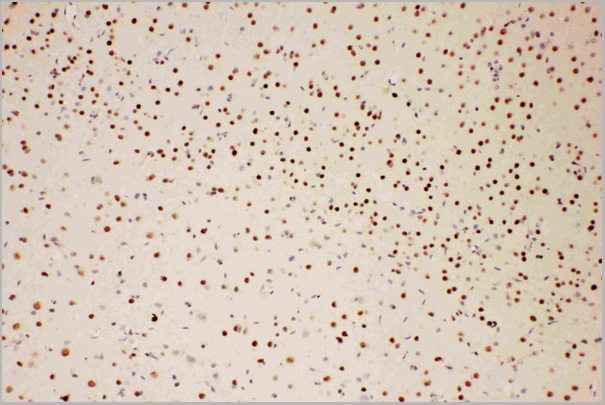 product-image-AAA11605_IHC3.jpg