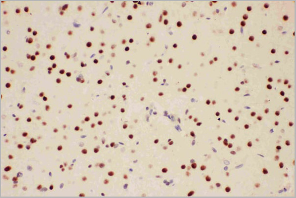 product-image-AAA11605_IHC4.jpg