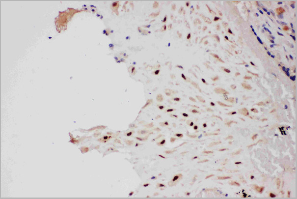 product-image-AAA11605_IHC5.jpg