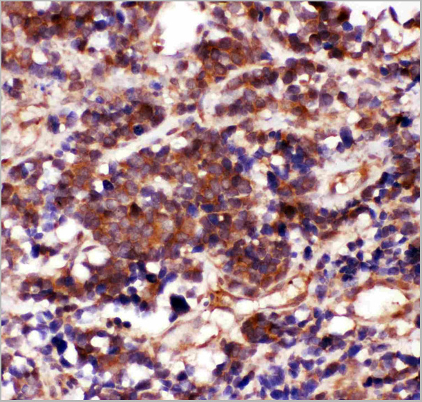 product-image-AAA11633_IHC2.jpg