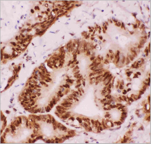 product-image-AAA11634_IHC2.jpg