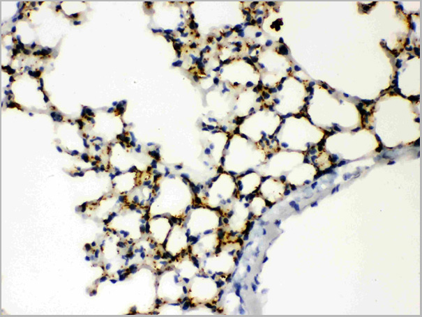 product-image-AAA11644_IHC2.jpg