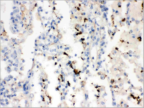 product-image-AAA11644_IHC4.jpg