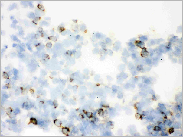 product-image-AAA11644_IHC5.jpg