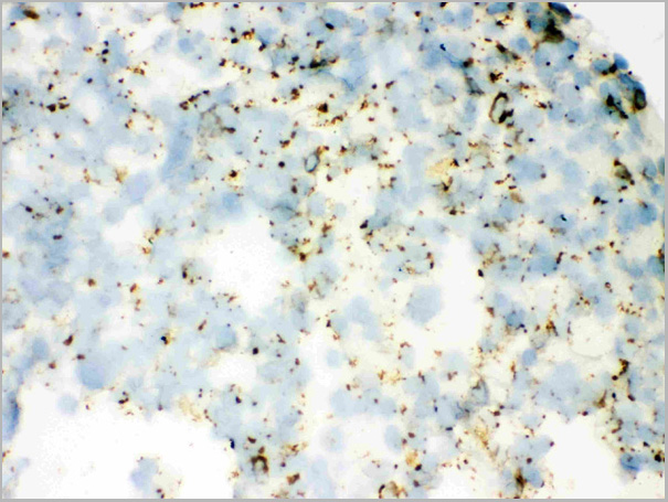 product-image-AAA11644_IHC6.jpg