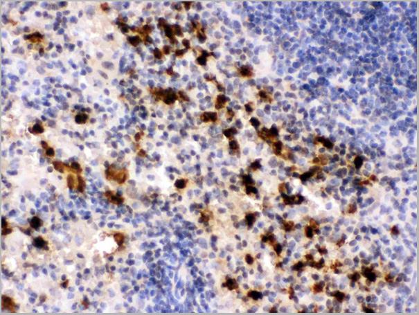 product-image-AAA11645_IHC2.jpg