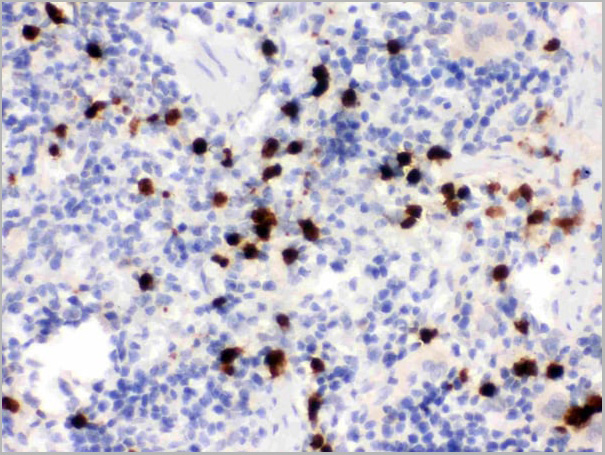product-image-AAA11645_IHC3.jpg