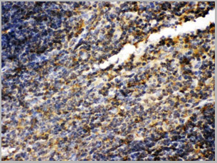 product-image-AAA11646_IHC2.jpg