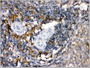 product-image-AAA11646_IHC3.jpg