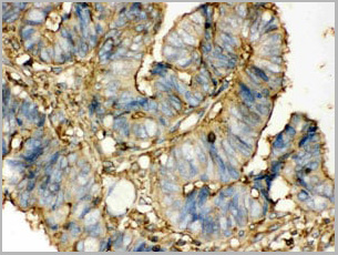 product-image-AAA11646_IHC4.jpg