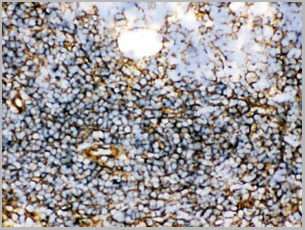 product-image-AAA11646_IHC7.jpg
