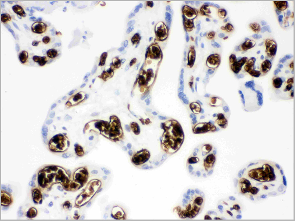 product-image-AAA11648_IHC3.jpg