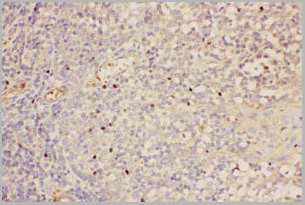 product-image-AAA11651_IHC.jpg
