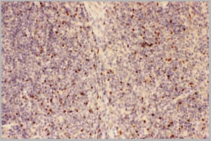 product-image-AAA11651_IHC2.jpg