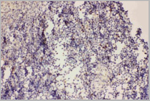product-image-AAA11651_IHC3.jpg