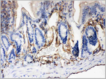 product-image-AAA11652_IHC2.jpg