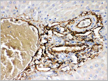 product-image-AAA11652_IHC3.jpg