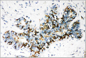 product-image-AAA11652_IHC4.jpg