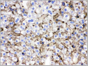 product-image-AAA11653_IHC5.jpg