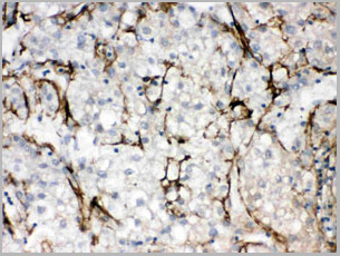 product-image-AAA11653_IHC6.jpg
