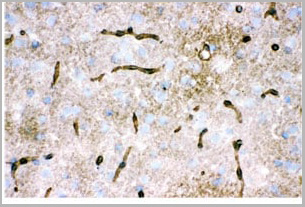 product-image-AAA11657_IHC2.jpg