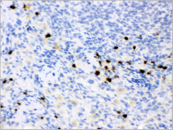 product-image-AAA11663_IHC3.jpg