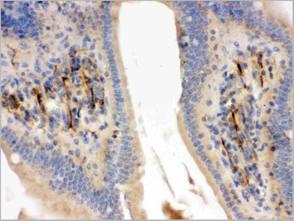 product-image-AAA11664_IHC2.jpg