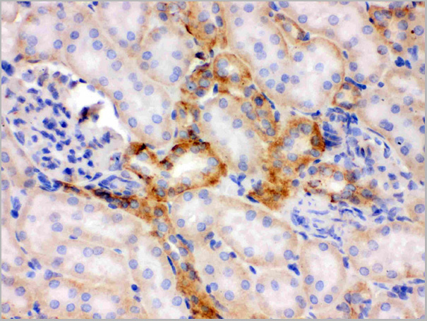 product-image-AAA11664_IHC3.jpg
