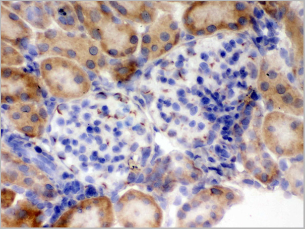 product-image-AAA11664_IHC5.jpg