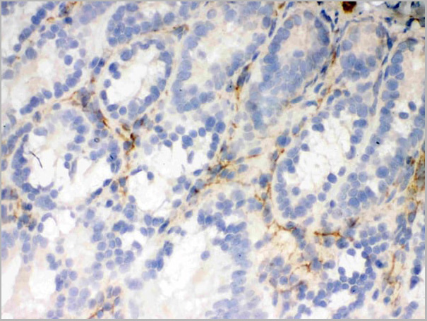 product-image-AAA11664_IHC6.jpg