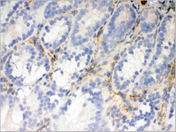 product-image-AAA11664_IHC7.jpg