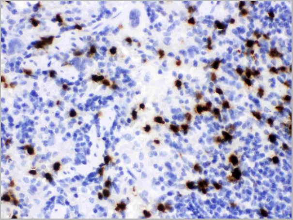 product-image-AAA11670_IHC2.jpg