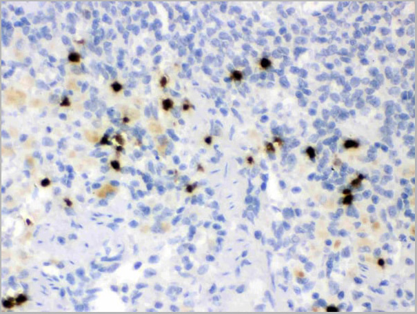 product-image-AAA11670_IHC3.jpg