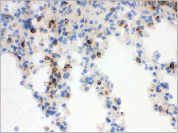 product-image-AAA11670_IHC4.jpg