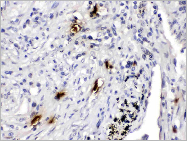 product-image-AAA11674_IHC2.jpg