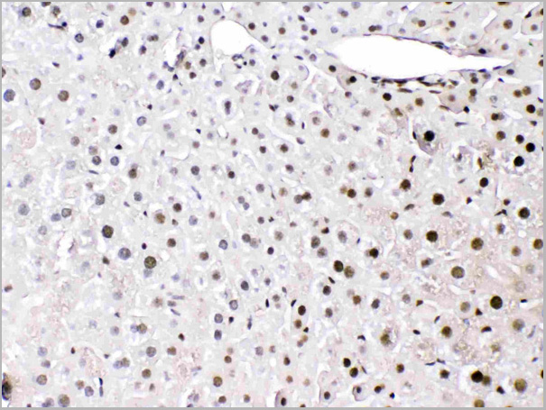 product-image-AAA11677_IHC3.jpg