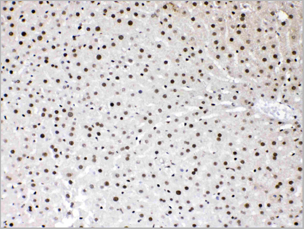 product-image-AAA11677_IHC5.jpg