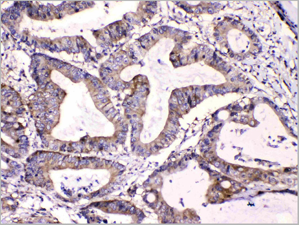 product-image-AAA11679_IHC2.jpg